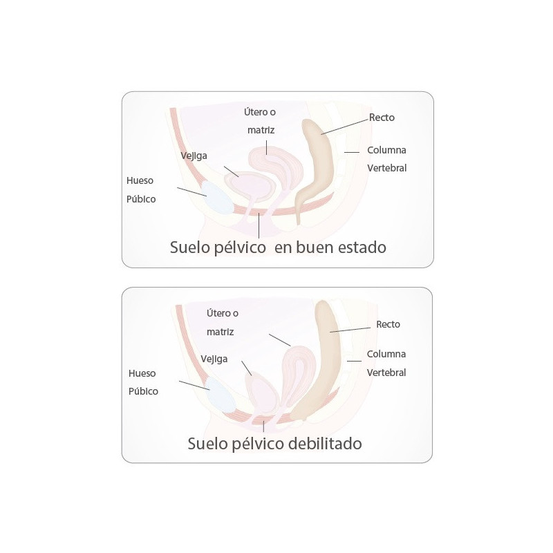 Set Cono Vaginal Pelvix Concept
