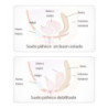 Set Cono Vaginal Pelvix Concept