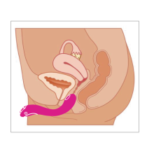 Estimulador Recargable Vibrador App Control Osci By Lovense